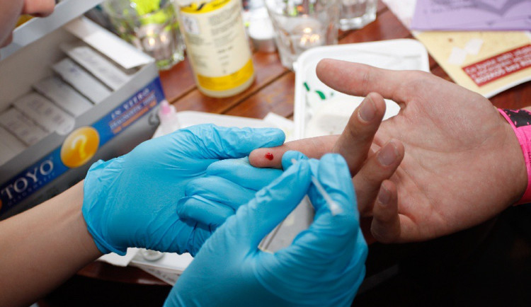 Čtyři místa na Vysočině tento týden nabízí testování na HIV a žloutenku