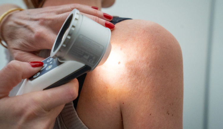 Spolu proti melanomu: Odborníci na jihlavském náměstí vyšetří lidem znaménka