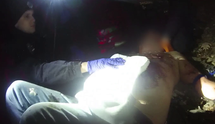 Díra v břiše, potrhané ruce. Policie zveřejnila drsné video muže zraněného petardou